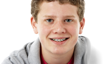 Early orthodontic treatment for teenagers, Mosman Park Orthodontics, Orthodontist South of the River in Perth